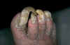 toes.jpg (23813 bytes)